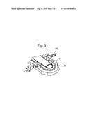 CONDUCTIVE AND DEGRADABLE IMPLANT FOR PELVIC TISSUE TREATMENT diagram and image