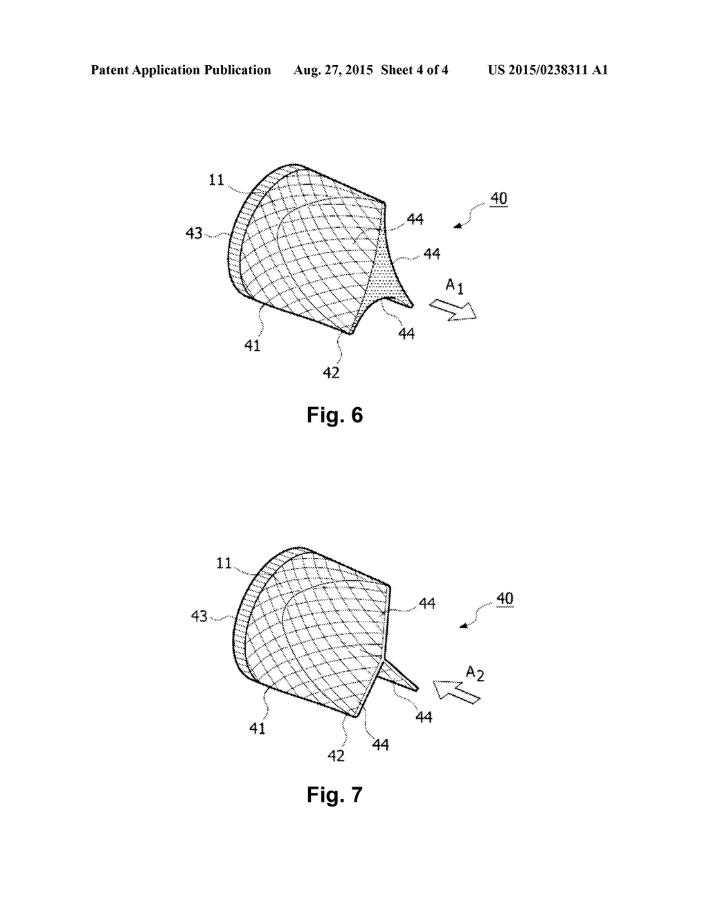 IMPLANTABLE VALVE PROSTHESIS AND METHOD FOR MANUFACTURING SUCH A VALVE - diagram, schematic, and image 05