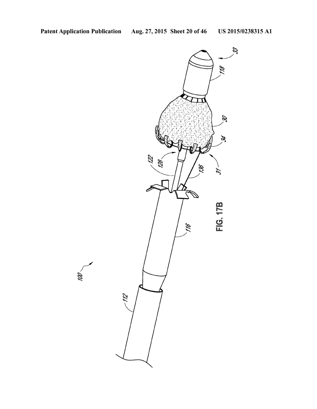 PROSTHESIS, DELIVERY DEVICE AND METHODS OF USE - diagram, schematic, and image 21