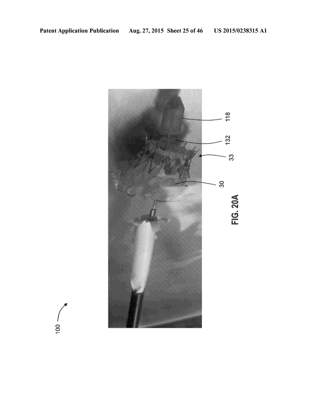 PROSTHESIS, DELIVERY DEVICE AND METHODS OF USE - diagram, schematic, and image 26