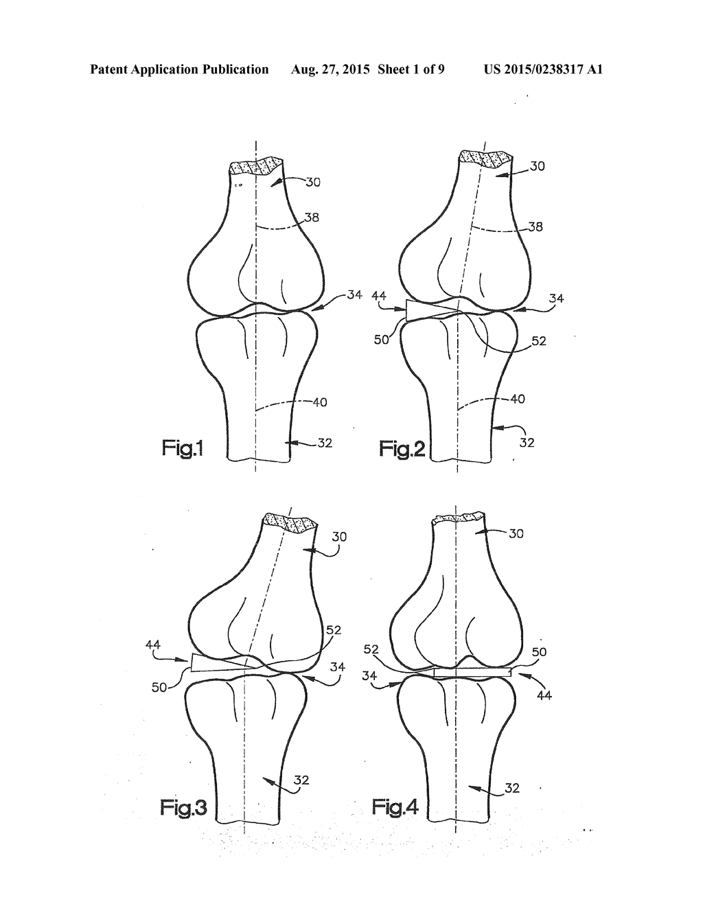 JOINT SPACER - diagram, schematic, and image 02