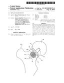 Implant Fixation Device diagram and image