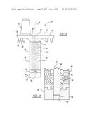 Implant Fixation Device diagram and image