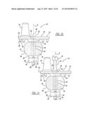 Implant Fixation Device diagram and image