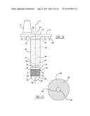 Implant Fixation Device diagram and image