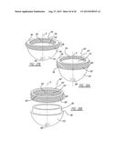 Implant Fixation Device diagram and image