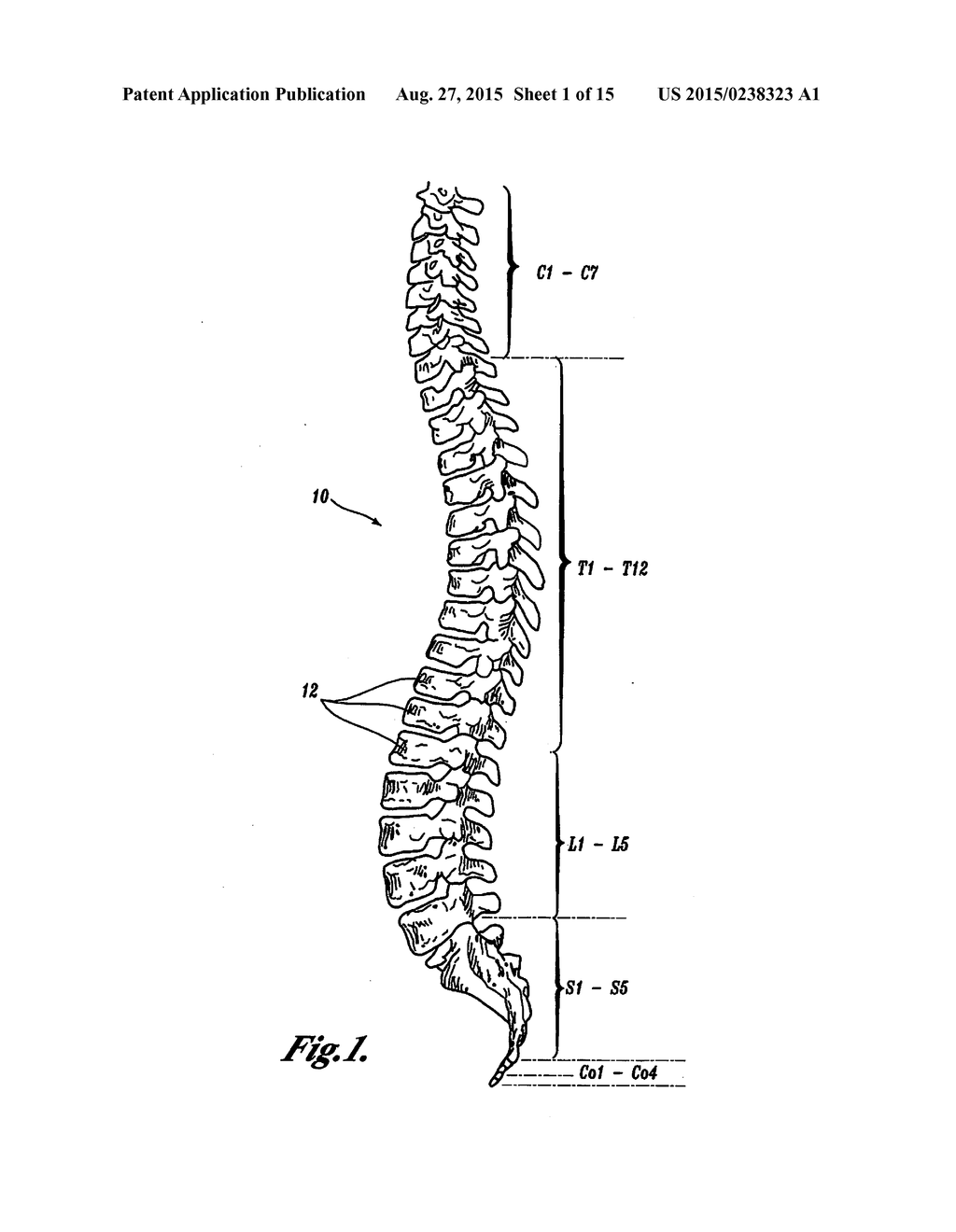 POLYAXIAL ADJUSTMENT OF FACET JOINT PROSTHESES - diagram, schematic, and image 02