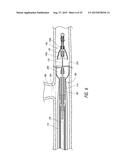 DELIVERY OF MEDICAL DEVICES diagram and image