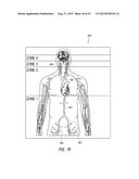 DELIVERY OF MEDICAL DEVICES diagram and image