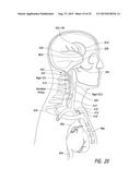 DELIVERY OF MEDICAL DEVICES diagram and image