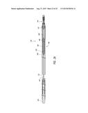 DELIVERY OF MEDICAL DEVICES diagram and image