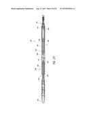 DELIVERY OF MEDICAL DEVICES diagram and image