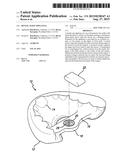 DENTAL SLEEP APPLIANCE diagram and image