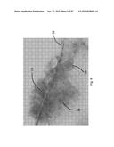 MEDICAMENT FOR TREATING PERIPHERAL NEUROPATHIES diagram and image