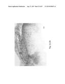 MEDICAMENT FOR TREATING PERIPHERAL NEUROPATHIES diagram and image