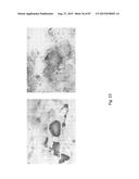 MEDICAMENT FOR TREATING PERIPHERAL NEUROPATHIES diagram and image