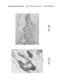 MEDICAMENT FOR TREATING PERIPHERAL NEUROPATHIES diagram and image