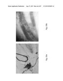 MEDICAMENT FOR TREATING PERIPHERAL NEUROPATHIES diagram and image