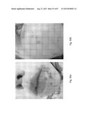 MEDICAMENT FOR TREATING PERIPHERAL NEUROPATHIES diagram and image