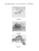 MEDICAMENT FOR TREATING PERIPHERAL NEUROPATHIES diagram and image