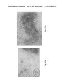 MEDICAMENT FOR TREATING PERIPHERAL NEUROPATHIES diagram and image