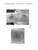 MEDICAMENT FOR TREATING PERIPHERAL NEUROPATHIES diagram and image