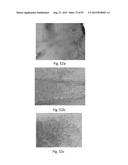 MEDICAMENT FOR TREATING PERIPHERAL NEUROPATHIES diagram and image