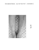 MEDICAMENT FOR TREATING PERIPHERAL NEUROPATHIES diagram and image