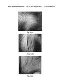 MEDICAMENT FOR TREATING PERIPHERAL NEUROPATHIES diagram and image