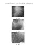 MEDICAMENT FOR TREATING PERIPHERAL NEUROPATHIES diagram and image