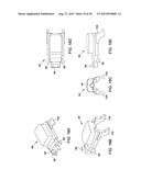 Intraocular implant delivery apparatus and methods of use thereof diagram and image