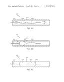 SYSTEMS AND METHODS FOR DELIVERING DRUGS TO A TREATMENT SITE diagram and image