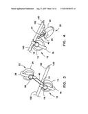 DEVICE FOR PREPARING AN IMPLANTED MEDICAL APPARATUS FOR EXTRACTION diagram and image