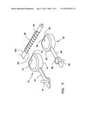 DEVICE FOR PREPARING AN IMPLANTED MEDICAL APPARATUS FOR EXTRACTION diagram and image