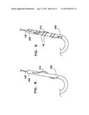 DEVICE FOR PREPARING AN IMPLANTED MEDICAL APPARATUS FOR EXTRACTION diagram and image