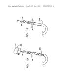 DEVICE FOR PREPARING AN IMPLANTED MEDICAL APPARATUS FOR EXTRACTION diagram and image