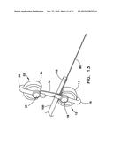 DEVICE FOR PREPARING AN IMPLANTED MEDICAL APPARATUS FOR EXTRACTION diagram and image