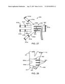 ELECTRODE STRUCTURES AND METHODS FOR THEIR USE IN CARDIOVASCULAR REFLEX     CONTROL diagram and image