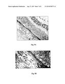 WATER SOLUBLE ANIONIC BACTERIOCHLOROPHYLL DERIVATIVES AND THEIR USES diagram and image