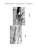 WATER SOLUBLE ANIONIC BACTERIOCHLOROPHYLL DERIVATIVES AND THEIR USES diagram and image