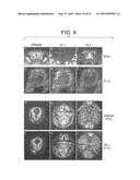 DRG11-RESPONSIVE (DRAGON) GENE FAMILY diagram and image