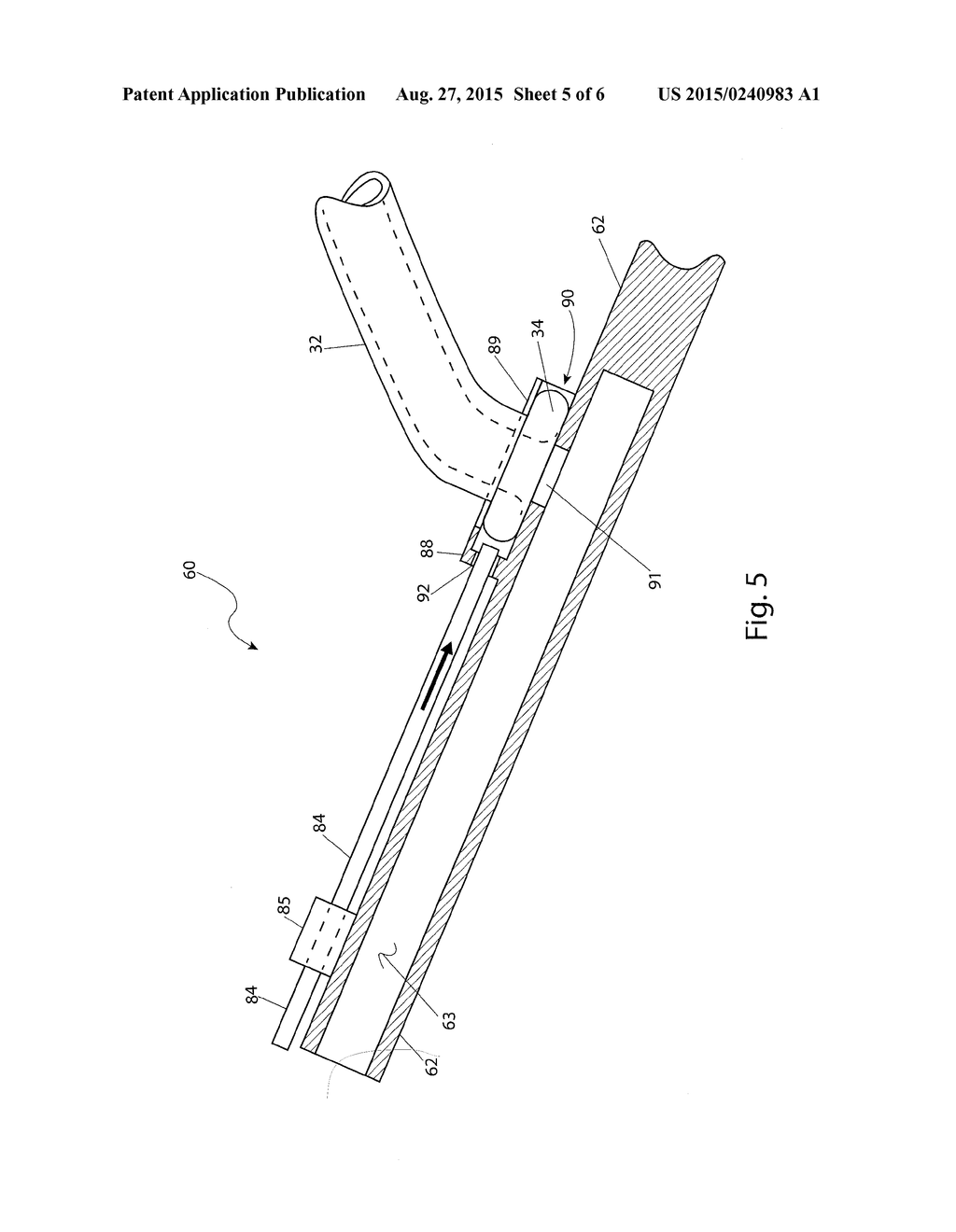 DEPLOYABLE PLUG SYSTEM - diagram, schematic, and image 06