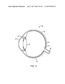 SELECTIVELY ATTENUATING LIGHT FROM THE OUTSIDE WORLD FOR AUGMENTED OR     VIRTUAL REALITY diagram and image