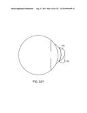 SELECTIVELY ATTENUATING LIGHT FROM THE OUTSIDE WORLD FOR AUGMENTED OR     VIRTUAL REALITY diagram and image