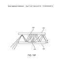 SELECTIVELY ATTENUATING LIGHT FROM THE OUTSIDE WORLD FOR AUGMENTED OR     VIRTUAL REALITY diagram and image