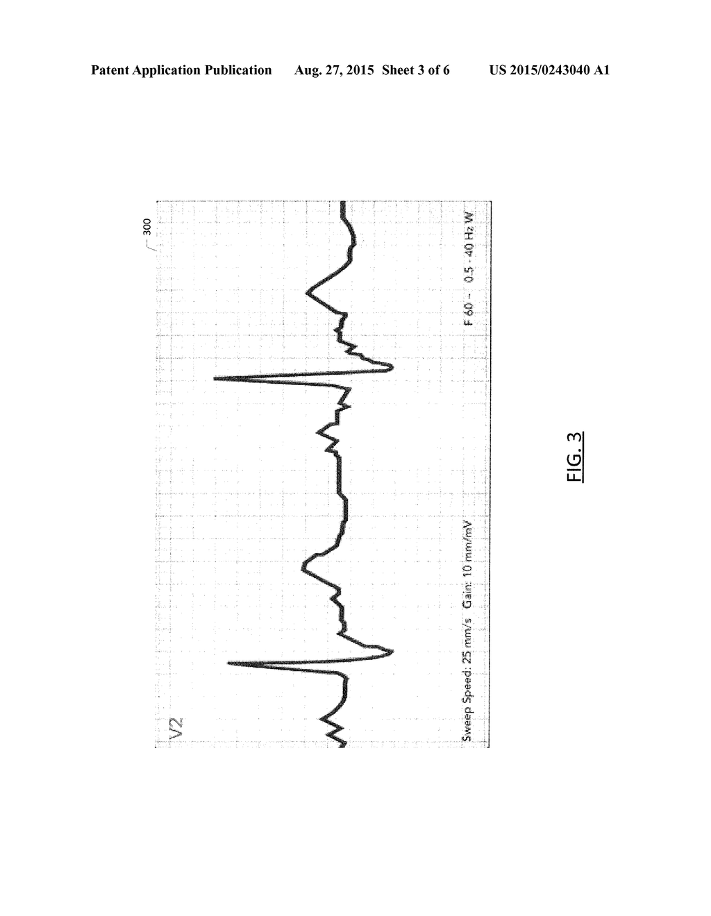 Method and apparatus for comparing portions of a waveform - diagram, schematic, and image 04