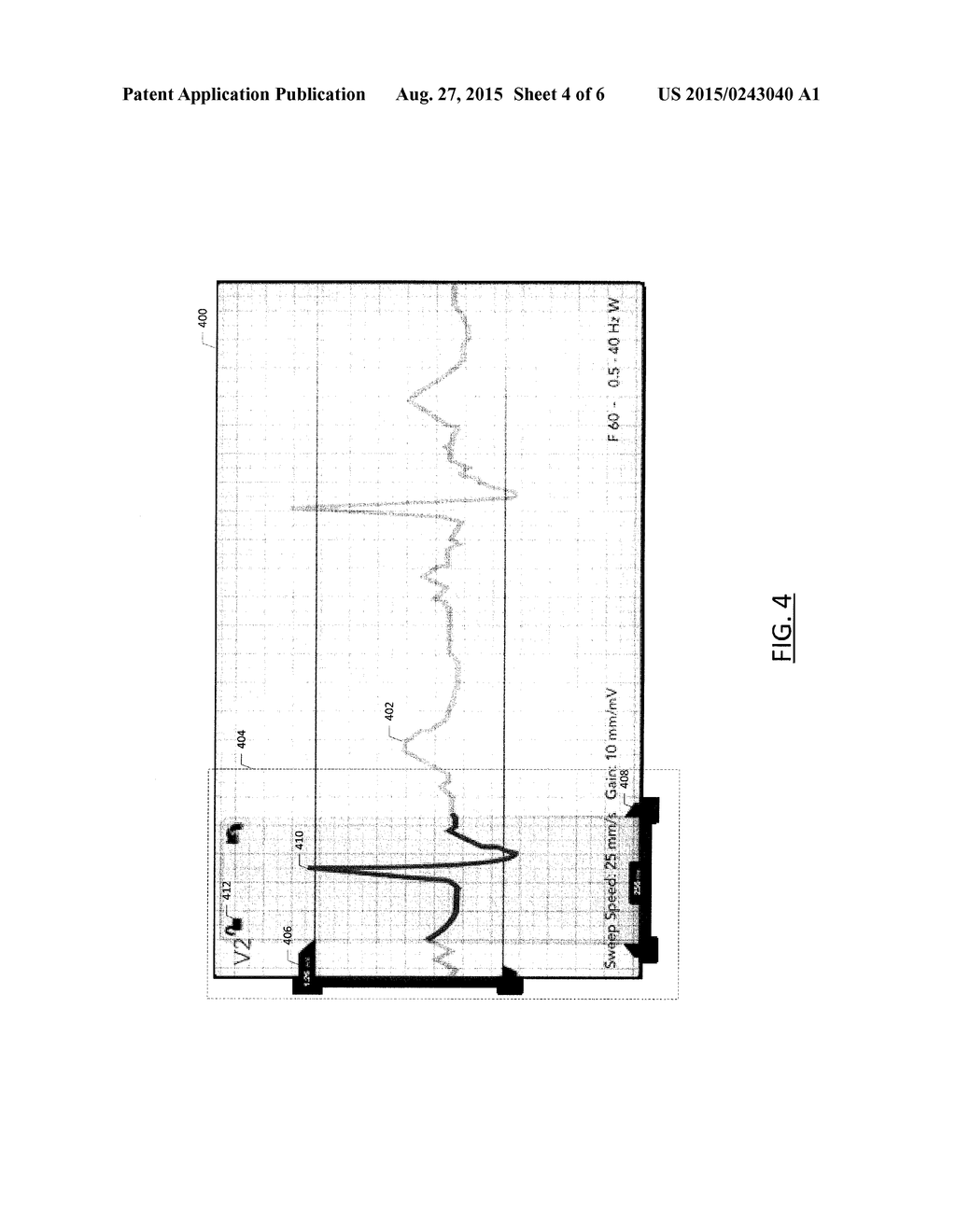 Method and apparatus for comparing portions of a waveform - diagram, schematic, and image 05
