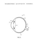 USING A FIBER SCANNING DISPLAY TO PRESENT A LIGHTFIELD TO A USER diagram and image