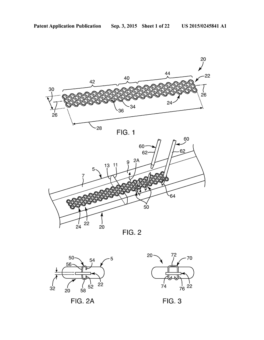 SOFT TISSUE REPAIR DEVICES, SYSTEMS, AND METHODS - diagram, schematic, and image 02