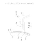 TRANSVASCULAR METHOD OF TREATING HYPERTENSION diagram and image